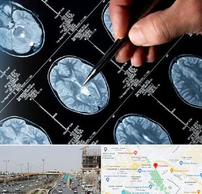 دکتر تشنج در بلوار توس مشهد 