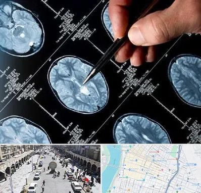 دکتر تشنج در نادری اهواز 