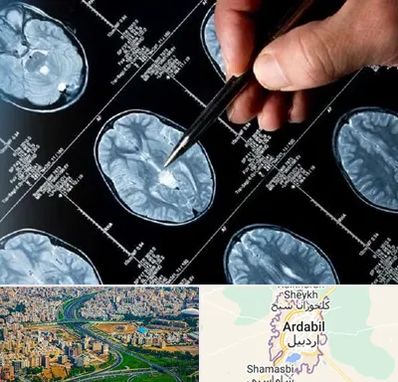 دکتر تشنج در اردبیل