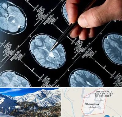 دکتر تشنج در شمشک