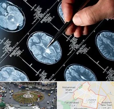 دکتر تشنج در فردیس کرج 