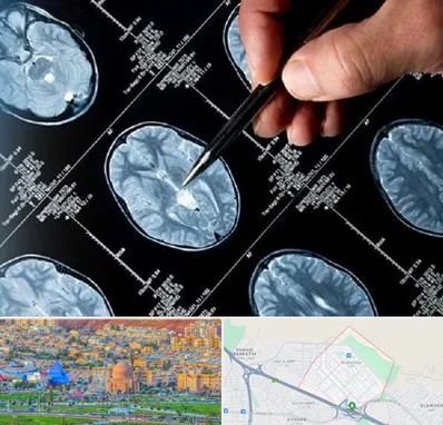 دکتر تشنج در رشدیه تبریز