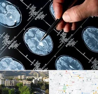 دکتر تشنج در دیباجی 