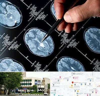 دکتر تشنج در طالقانی 