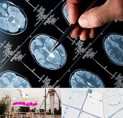 دکتر تشنج در پادادشهر اهواز