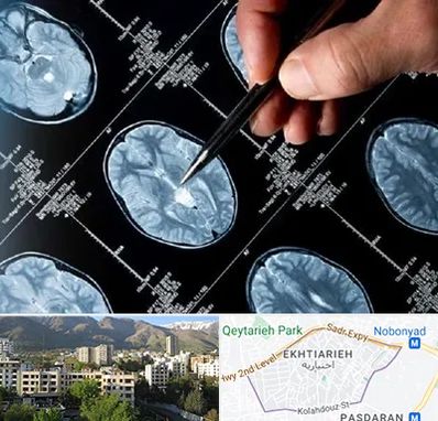 دکتر تشنج در اختیاریه 