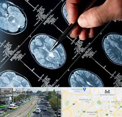 دکتر تشنج در جنوب تهران 