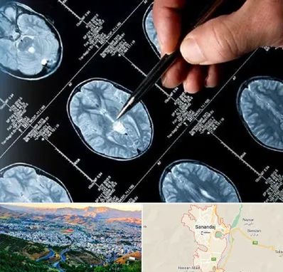 دکتر تشنج در سنندج