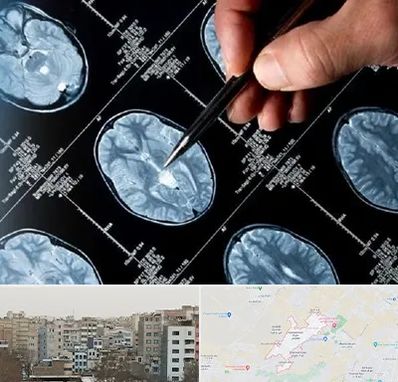 دکتر تشنج در محمد شهر کرج 