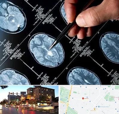 دکتر تشنج در بلوار سجاد مشهد 