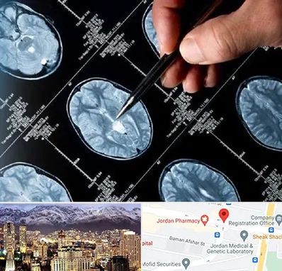 دکتر تشنج در جردن 