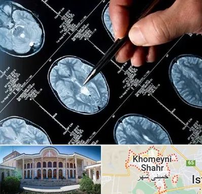 دکتر تشنج در خمینی شهر