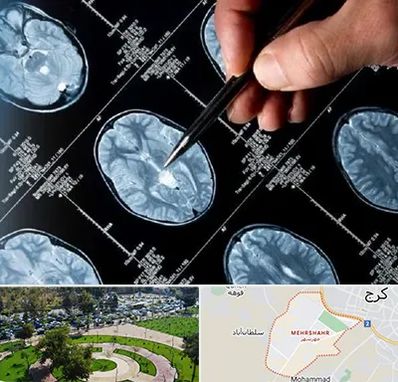 دکتر تشنج در مهرشهر کرج 