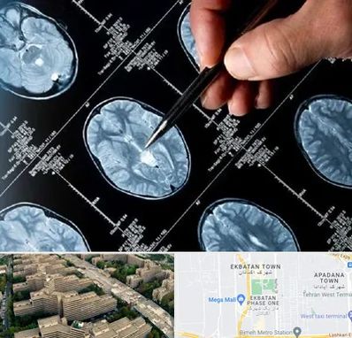 دکتر تشنج در اکباتان 