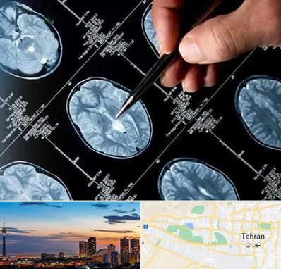 دکتر تشنج در غرب تهران 