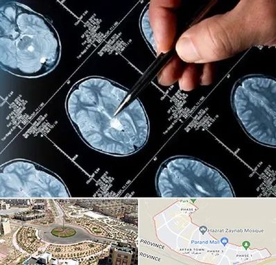 دکتر تشنج در پرند