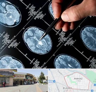 دکتر تشنج در پرواز تبریز