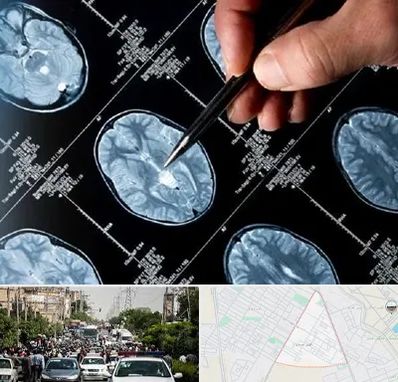 دکتر تشنج در سیدی مشهد