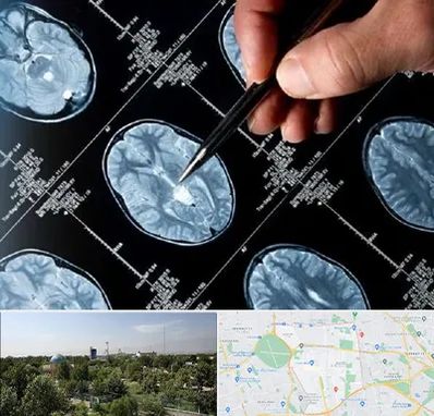 دکتر تشنج در منطقه 16 تهران 