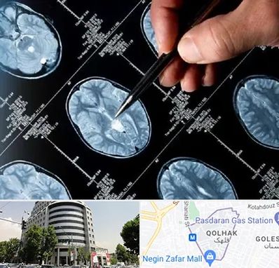 دکتر تشنج در قلهک 