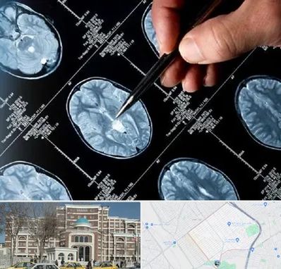 دکتر تشنج در طلاب مشهد