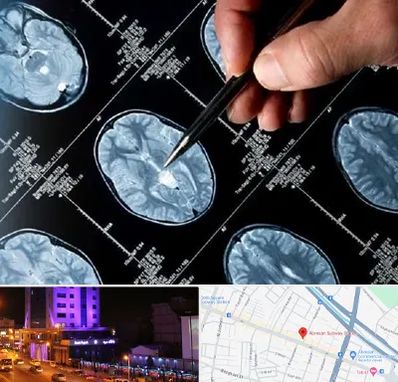 دکتر تشنج در آبرسان تبریز