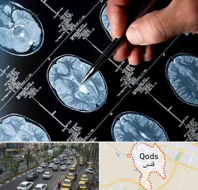 دکتر تشنج در شهر قدس