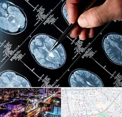 دکتر تشنج در منظریه رشت 