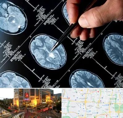 دکتر تشنج در جنت آباد تهران 