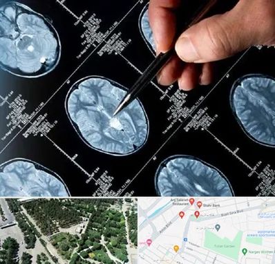 دکتر تشنج در سالاریه قم