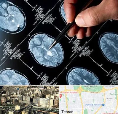 دکتر تشنج در مرزداران 