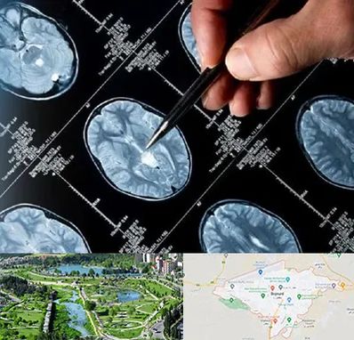 دکتر تشنج در بجنورد