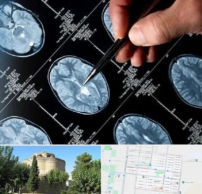 دکتر تشنج در مرداویج اصفهان 