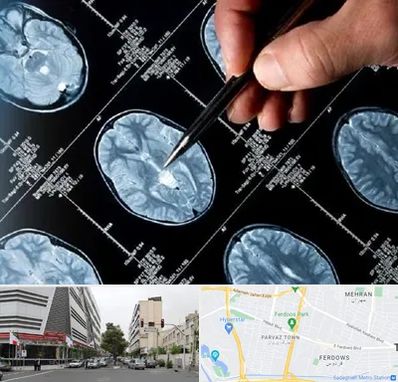 دکتر تشنج در بلوار فردوس 