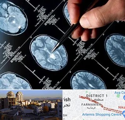 دکتر تشنج در فرمانیه 