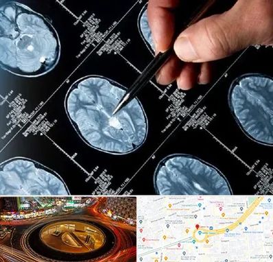 دکتر تشنج در میدان ولیعصر 