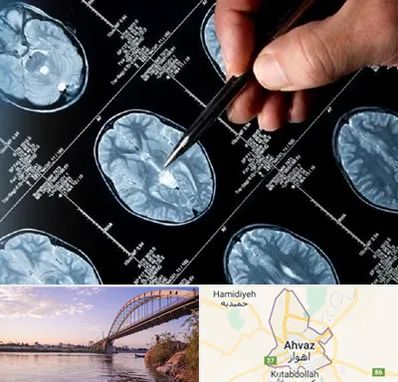 دکتر تشنج در اهواز