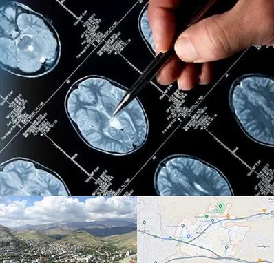 دکتر تشنج در رودهن