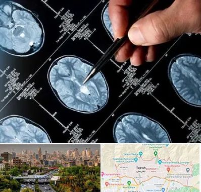 دکتر تشنج در منطقه 1 تهران