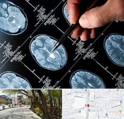 دکتر تشنج در خیابان توحید اصفهان 