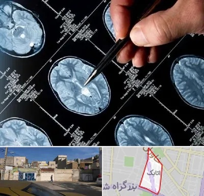 دکتر تشنج در اتابک