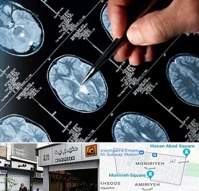 دکتر تشنج در منیریه 