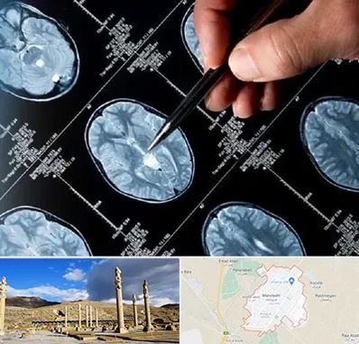 دکتر تشنج در مرودشت
