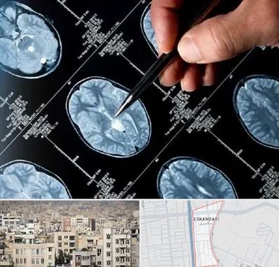 دکتر تشنج در اسکندری