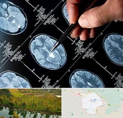 دکتر تشنج در بهبهان