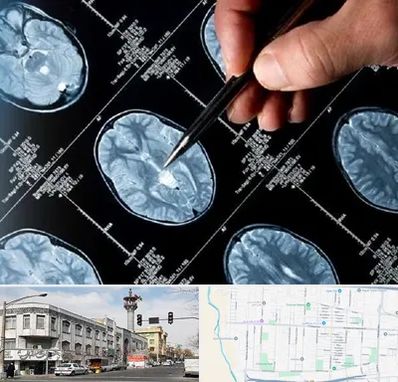 دکتر تشنج در 17شهریور