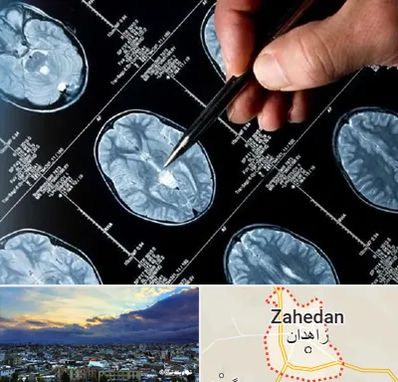 دکتر تشنج در زاهدان