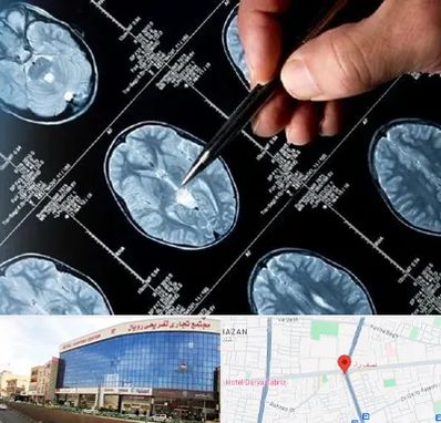 دکتر تشنج در نصف راه تبریز