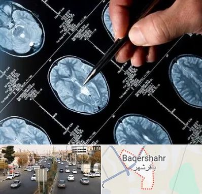 دکتر تشنج در باقرشهر