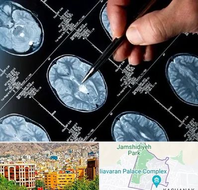 دکتر تشنج در نیاوران 